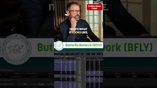 We Flagged BFLY Before the News. 300% Later, the Market Finally Understands What It Actually Is
